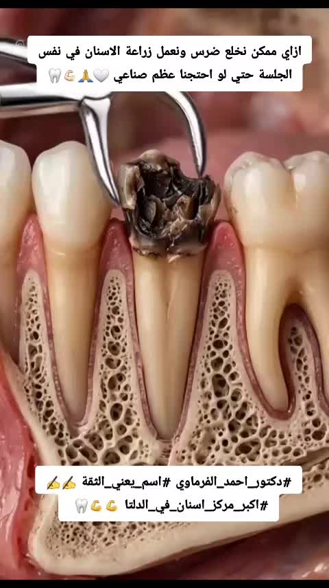 @دكتور احمد طلعت الفرماوي