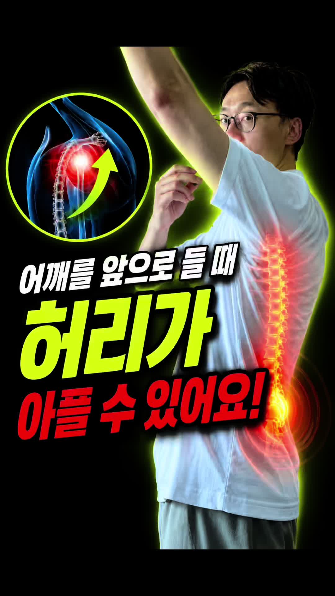 @재활운동촤이