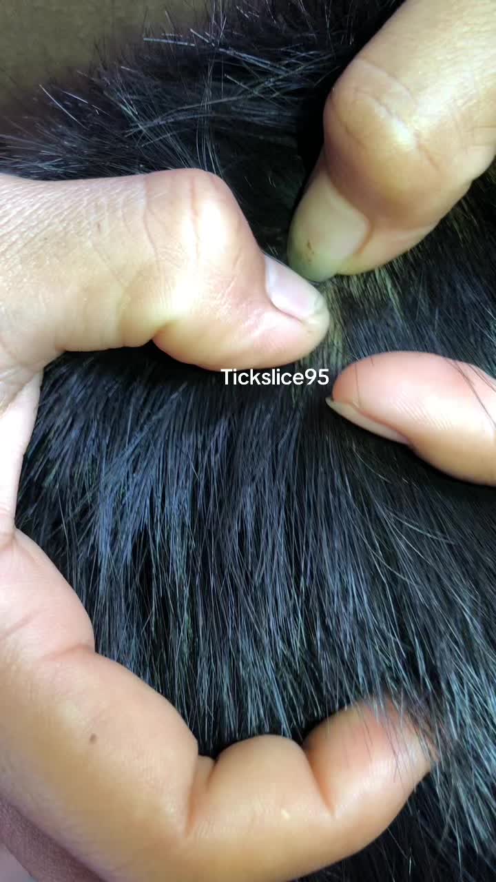 @Tickslice95