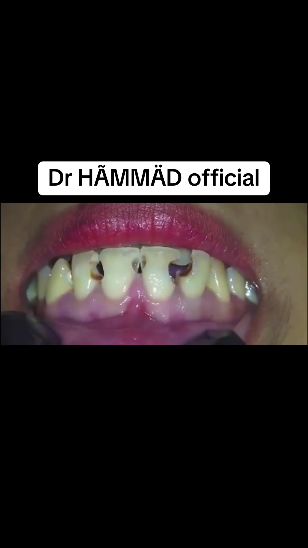 @🥀Dr_Hammad_official🥀
