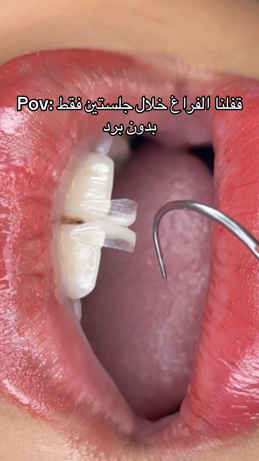 @Dr. Abrar Alhababi