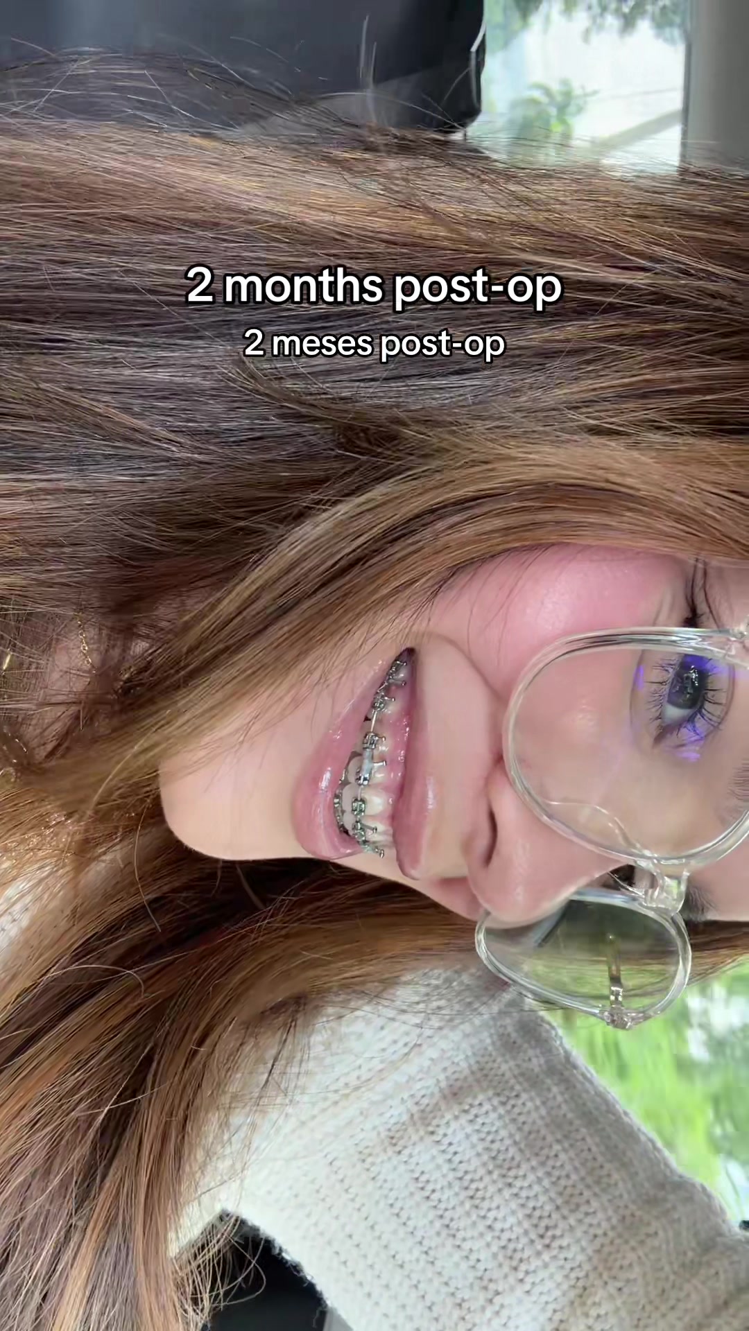 @alon🦋