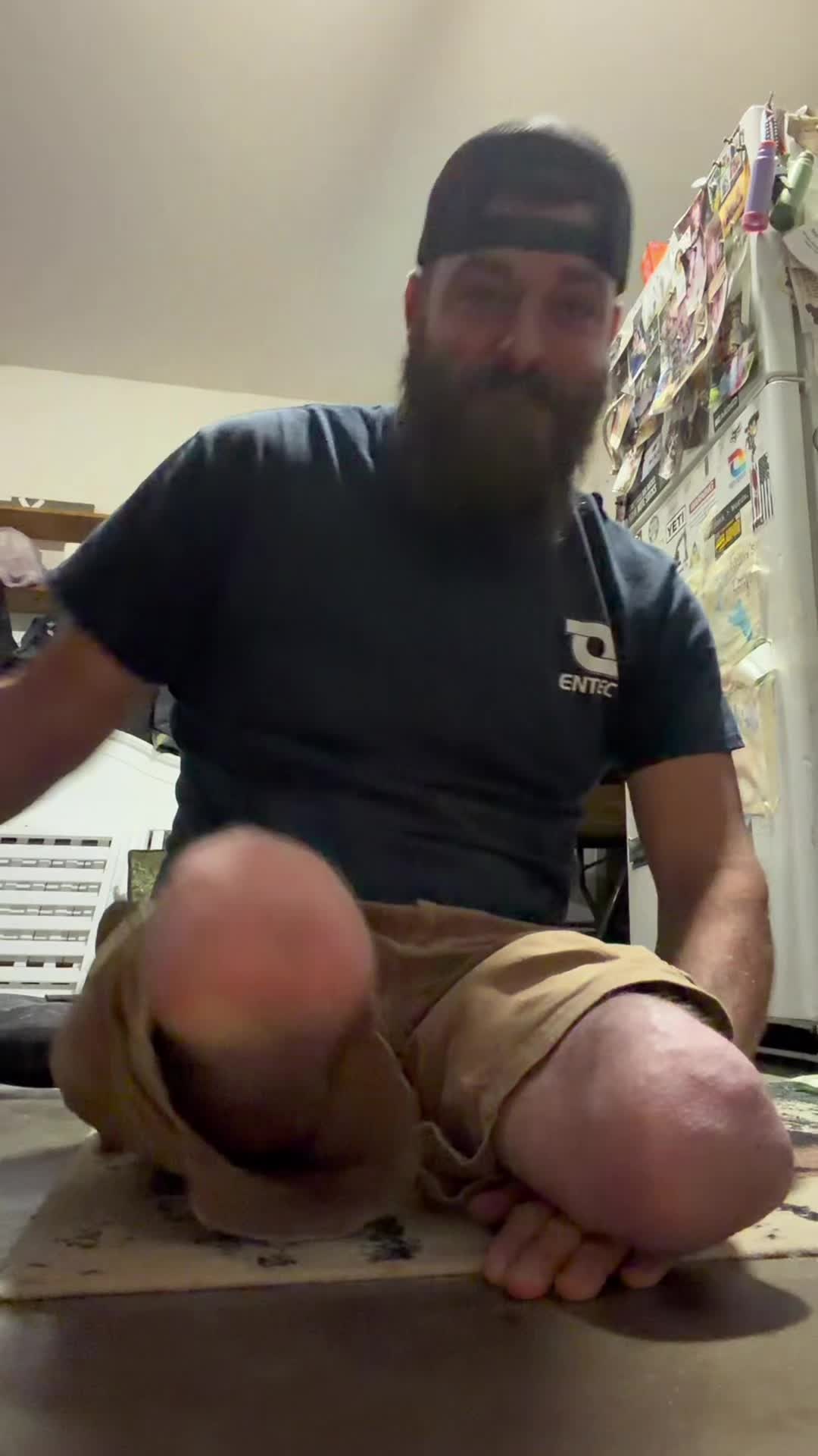 @Limb Loss Boss