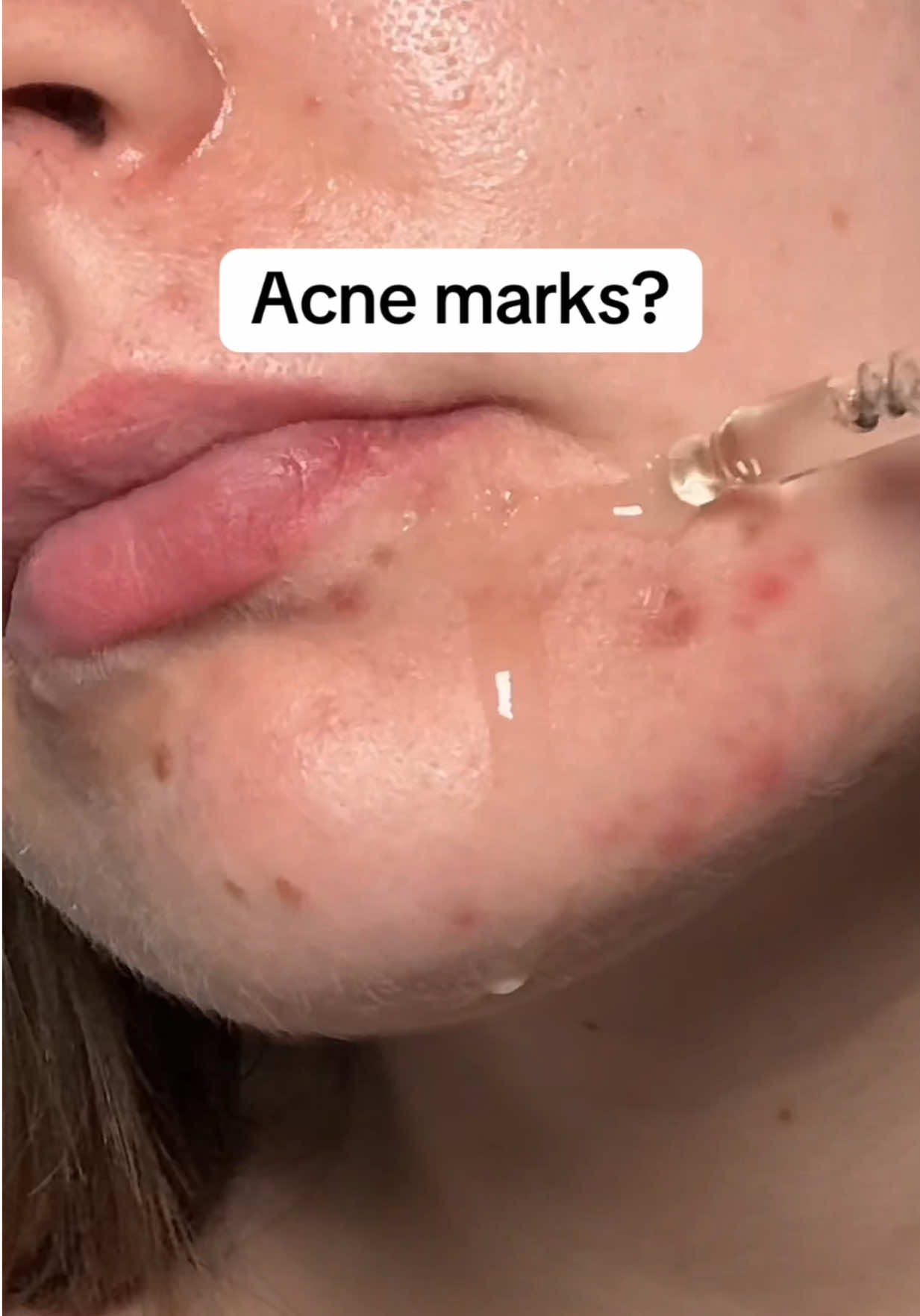 @watermelonsugarskin