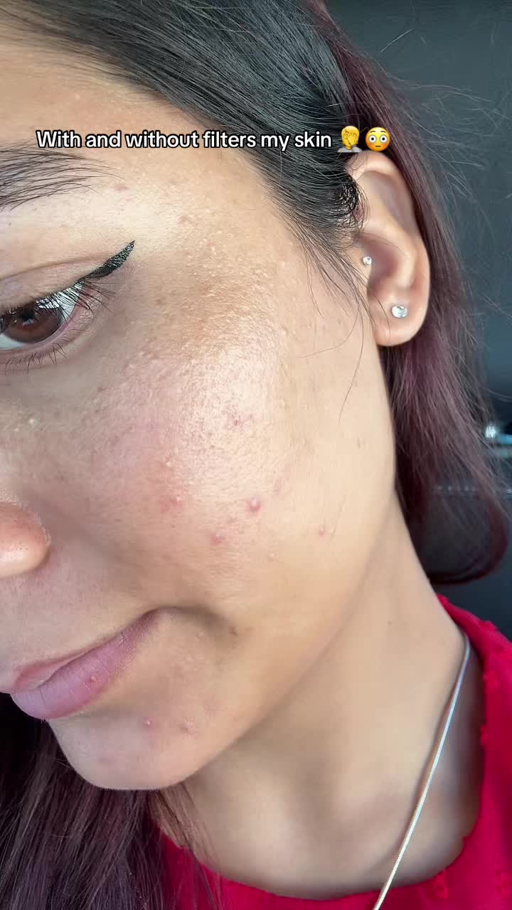 @Asmita Xettri ❤️🧿