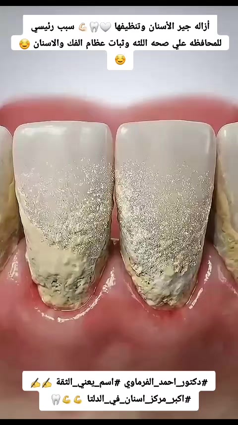 @دكتور احمد طلعت الفرماوي
