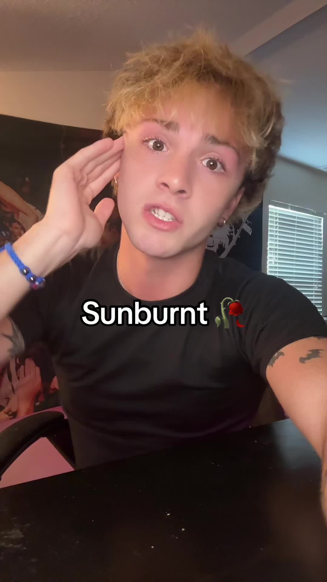 @matt burnss