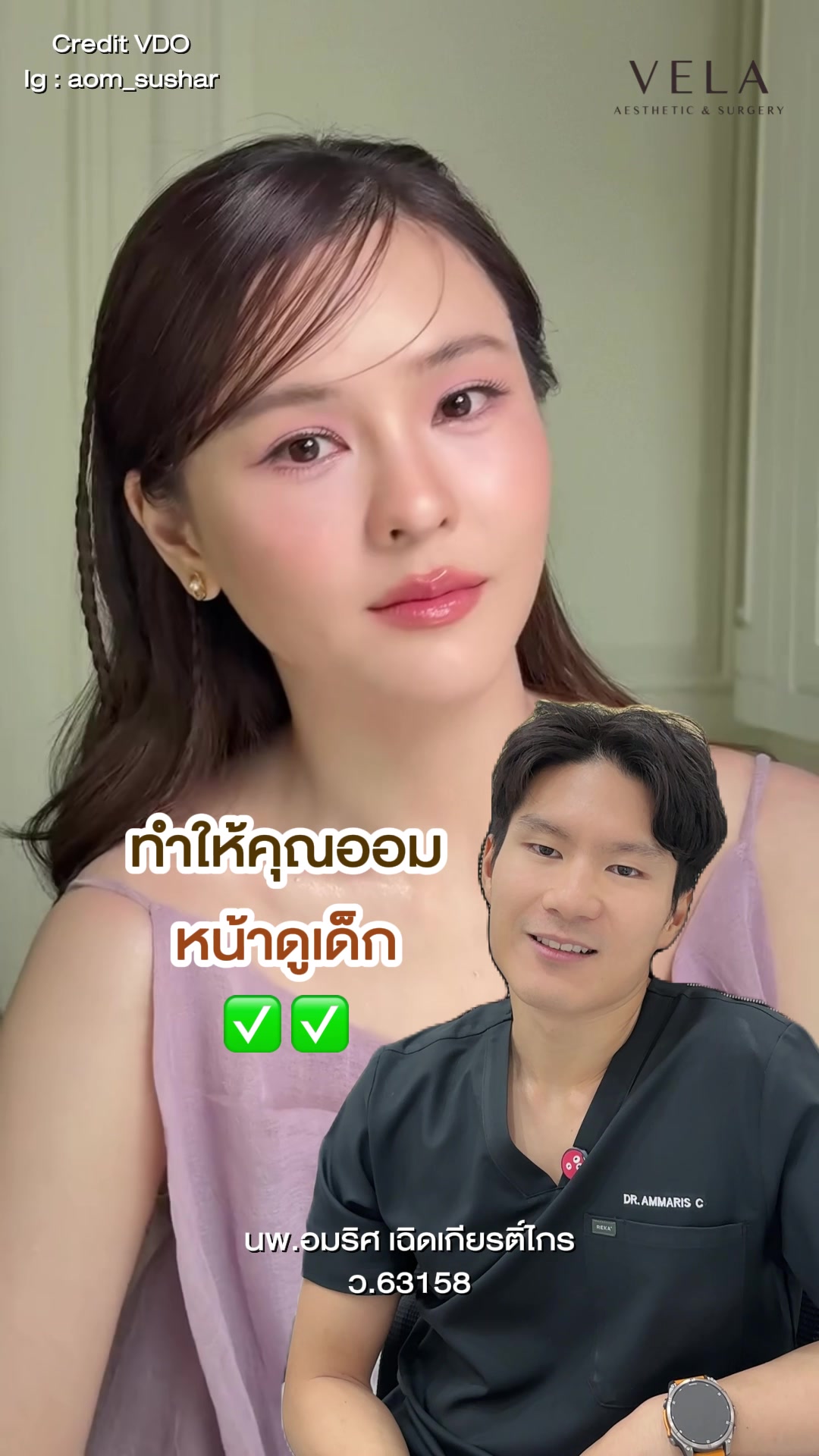 @เวลาคลินิก ตาสองชั้น ถุงใต้ตา