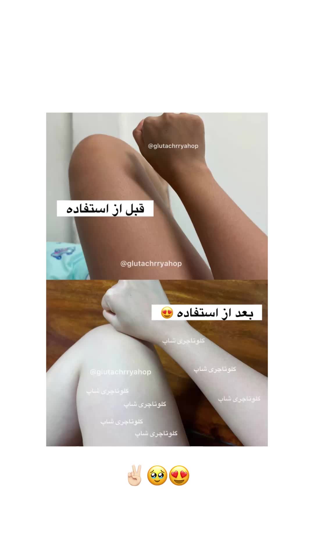 @گلوتاچری شاپ