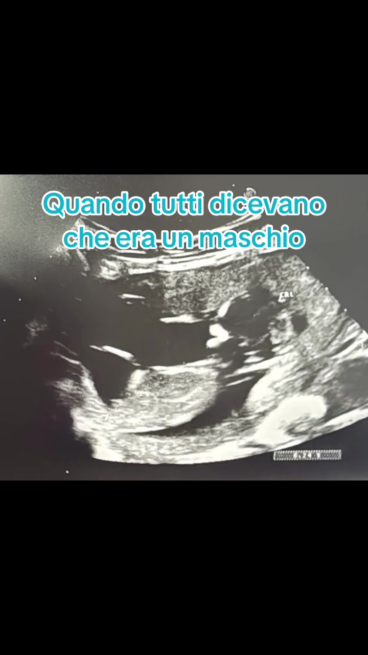 @Francesca02