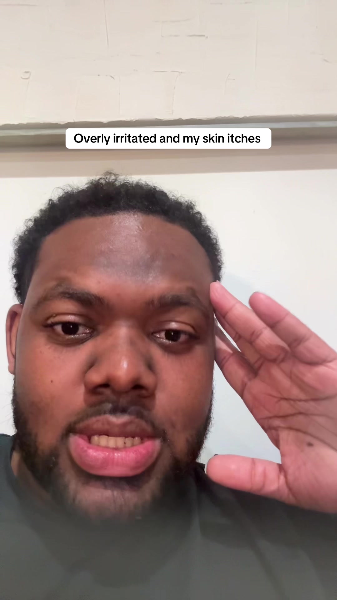 @TB