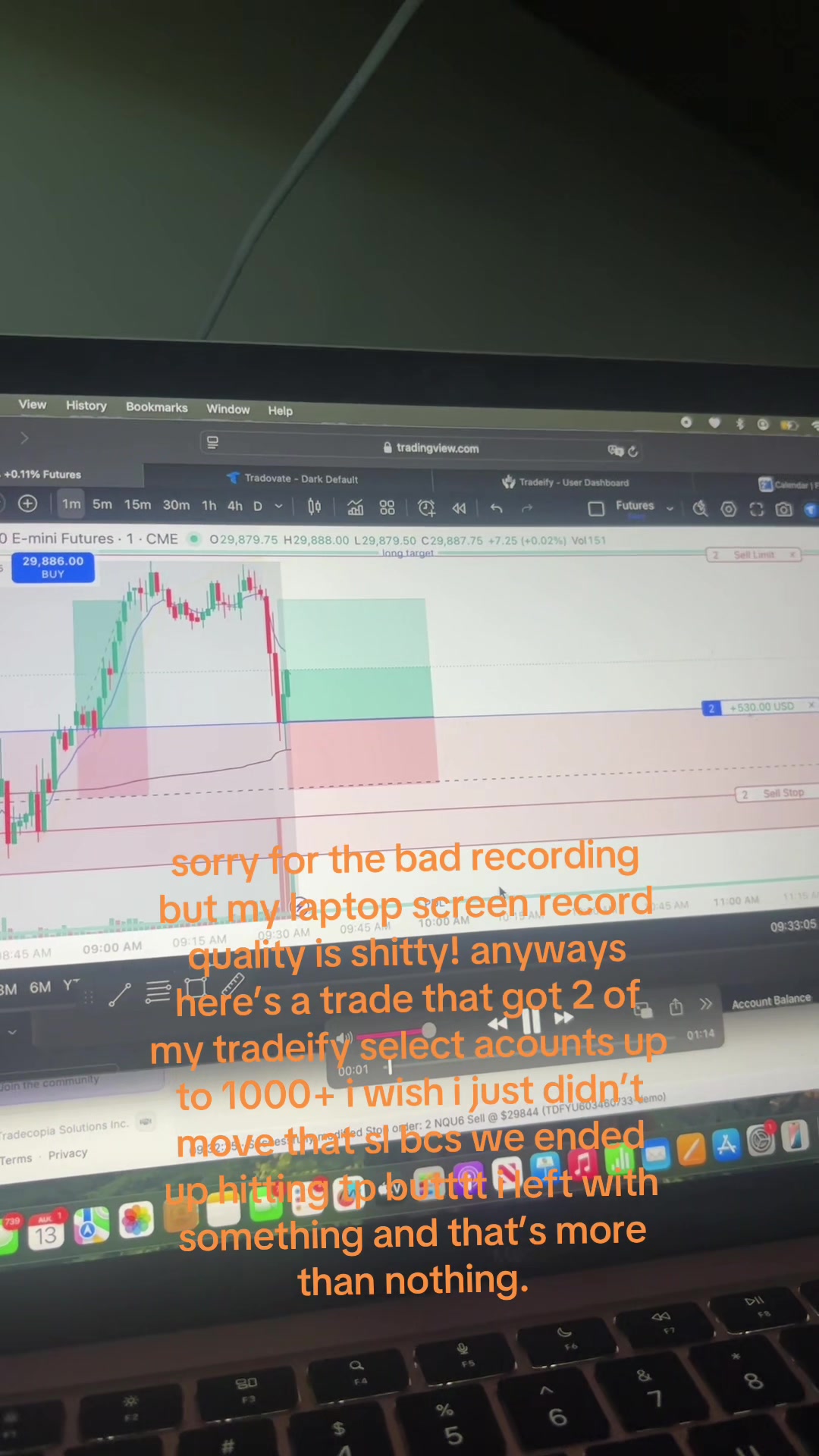 @leetrades