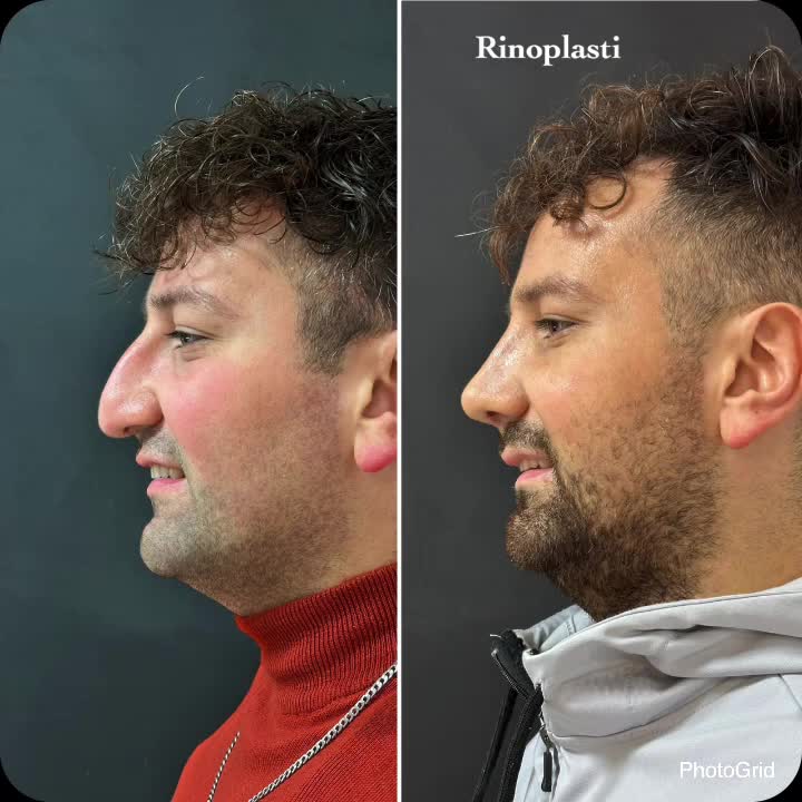 @Dr. NurtenKucuk