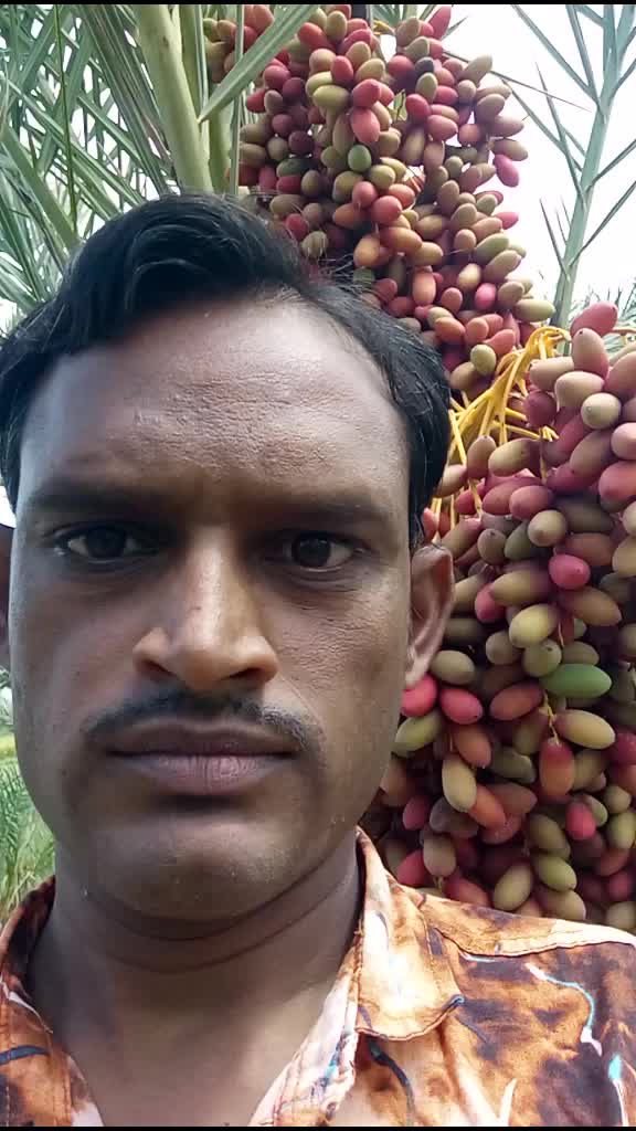 @Gopal Adgama