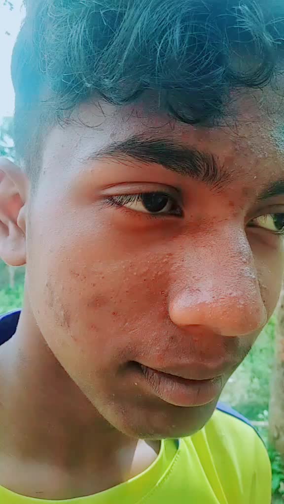 @Abhijith surendran A