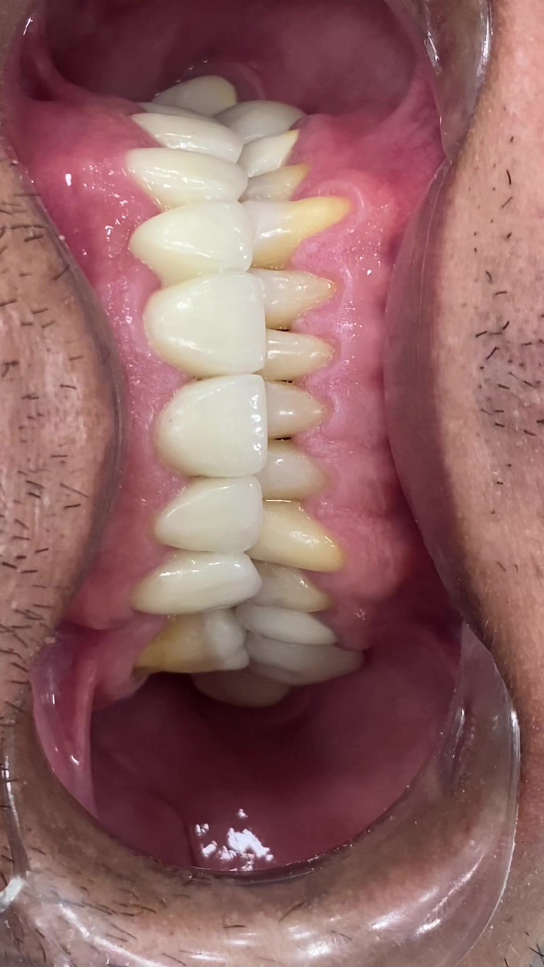 @DENTIST/ Anthony V. Guarniz