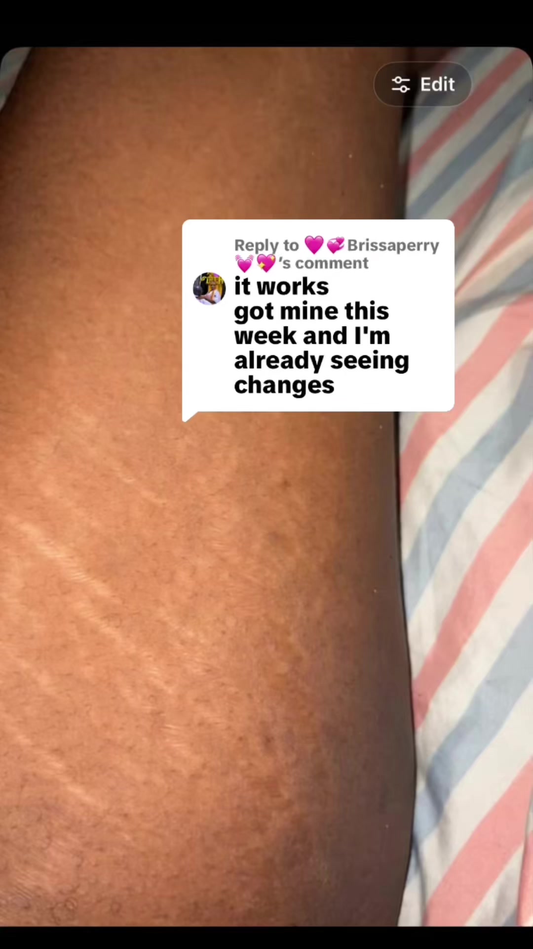 @Radiant skin