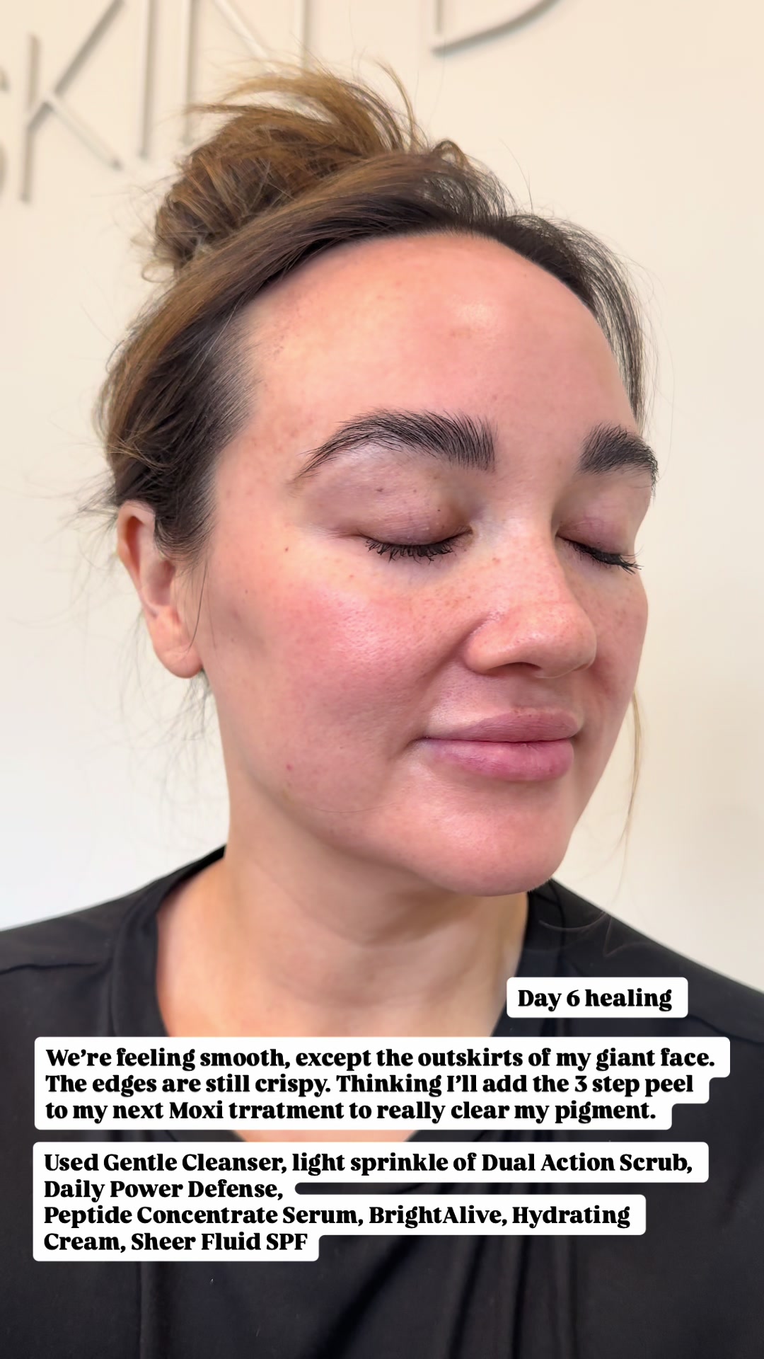 @Skin Design Aesthetics