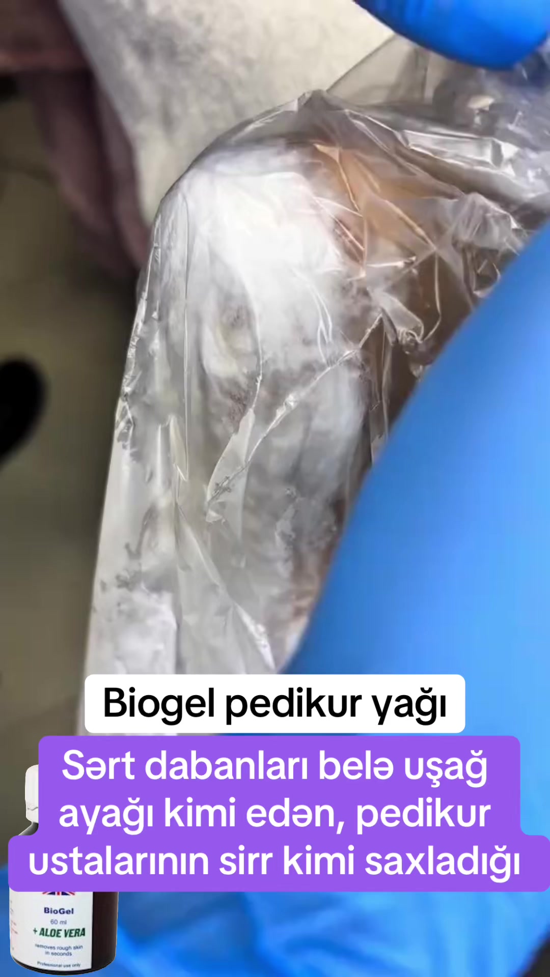 @Tük tökən Madura şam ağardıcı