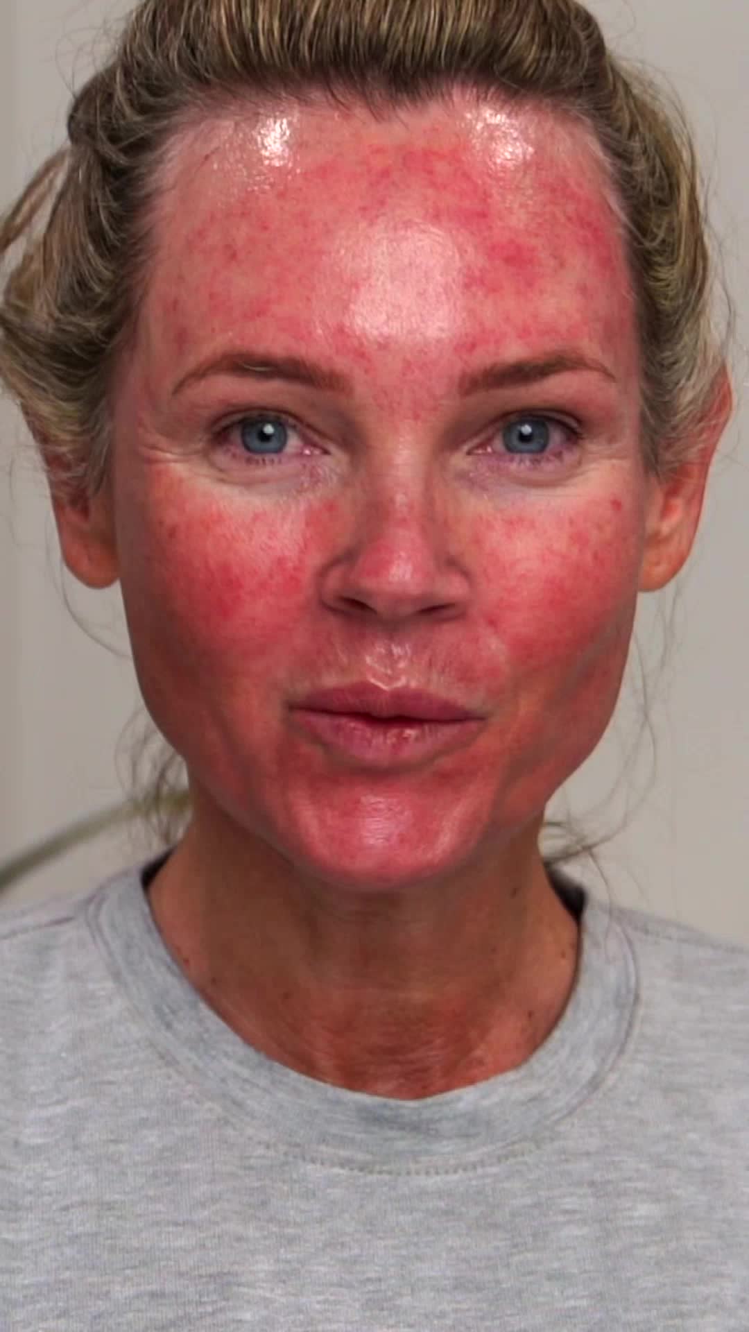 @DIY SKINCARE