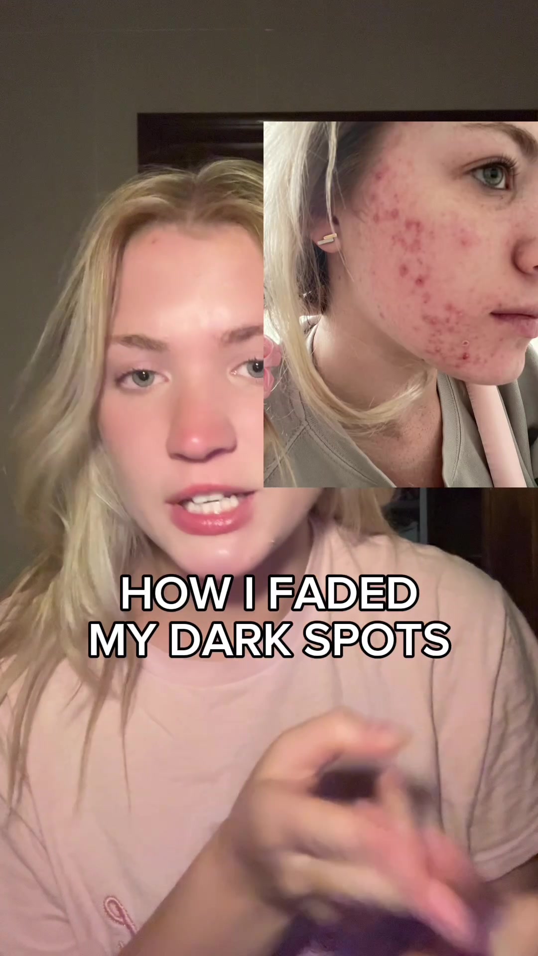 @bellytts