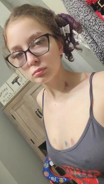 @bunnie <3