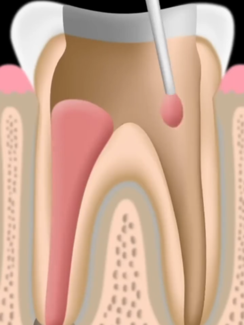 @Tech Dental