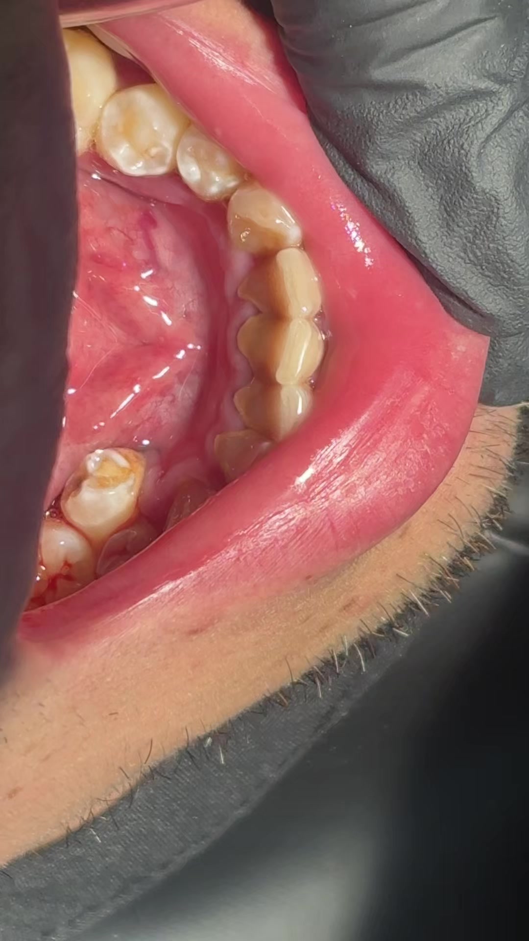 @Cava Clínica Dental 🦷