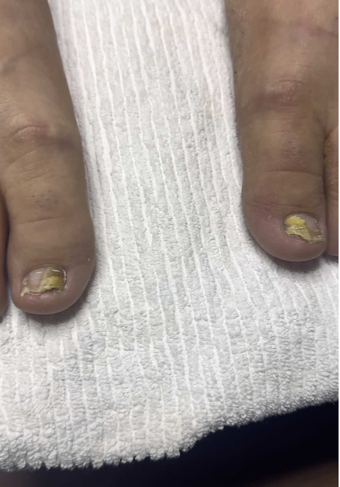 @ToesbyKoki