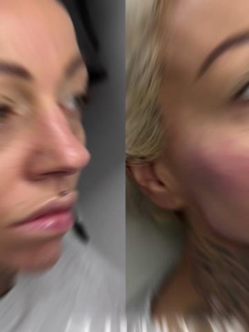 @Superfacial Aesthetics