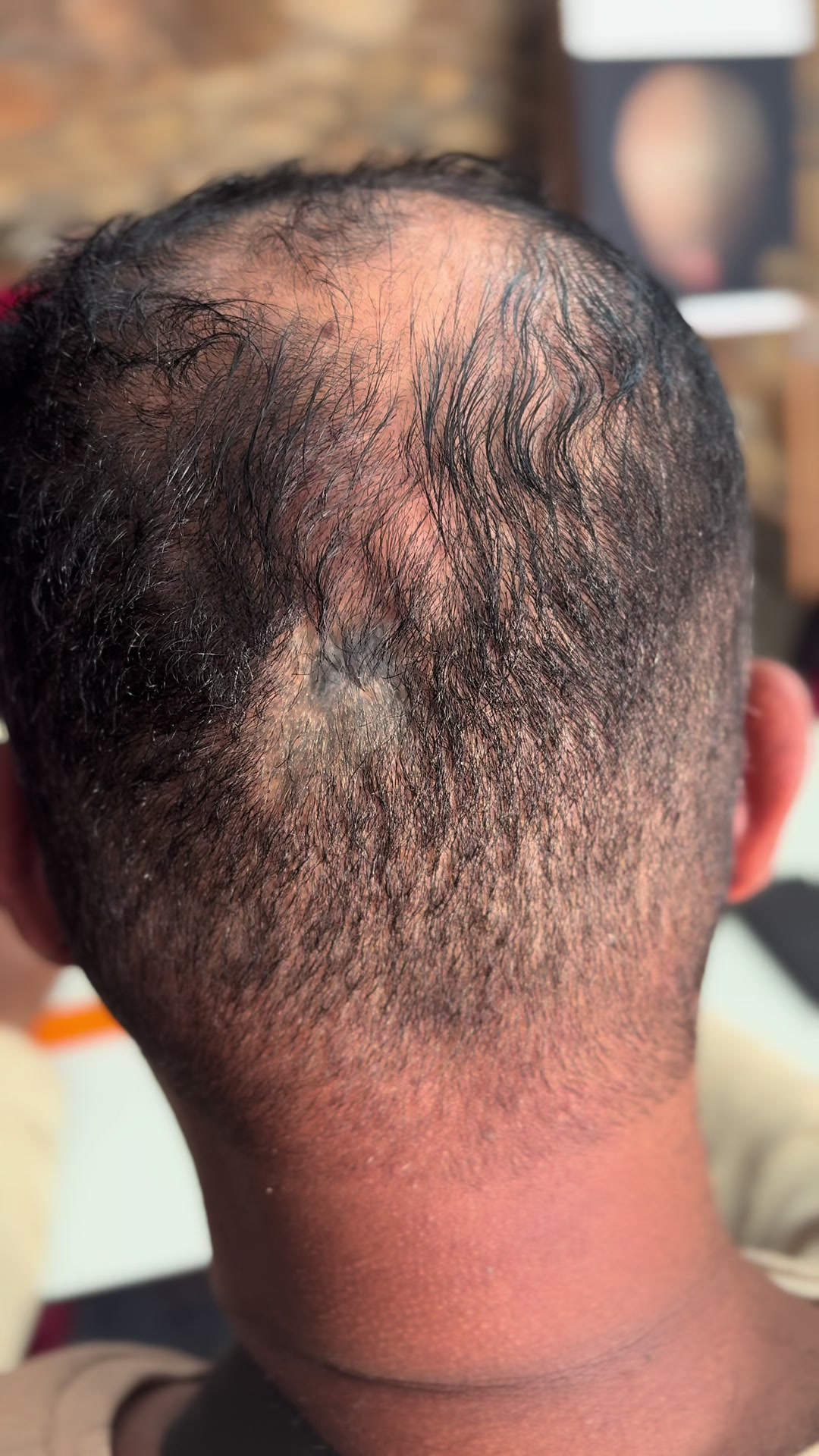 @Valesca Abi Ackel Scalp