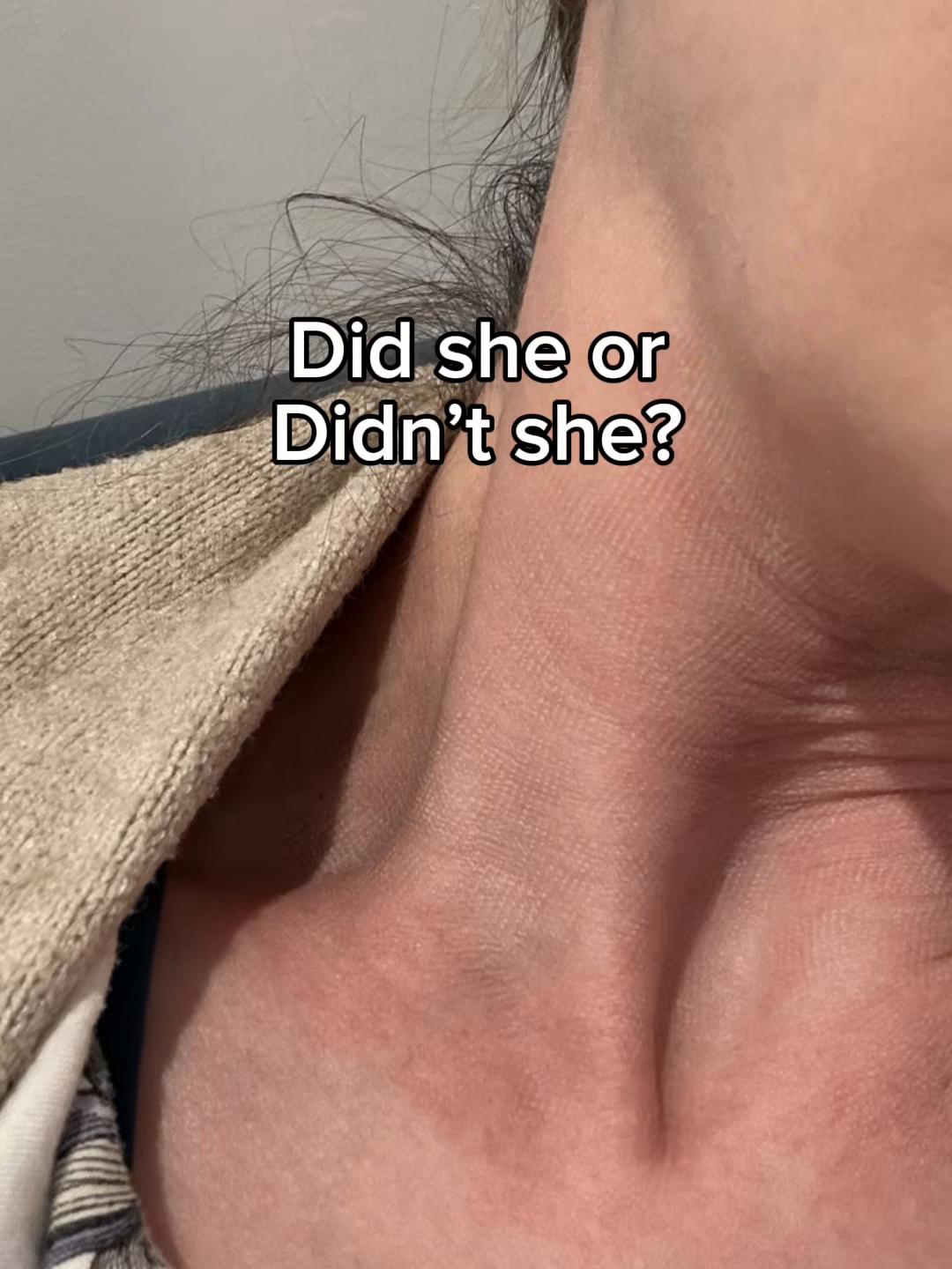 @Rosedermnyc