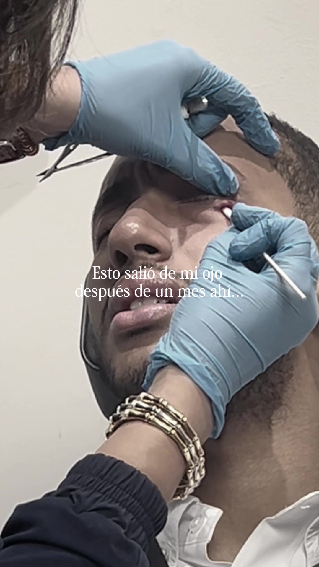 @Anibal O'neal