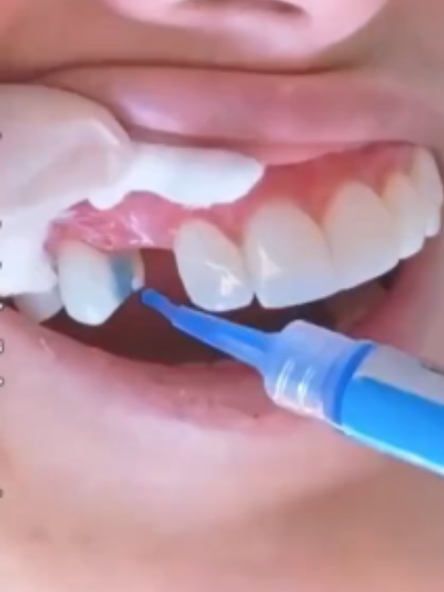 @Tech Dental