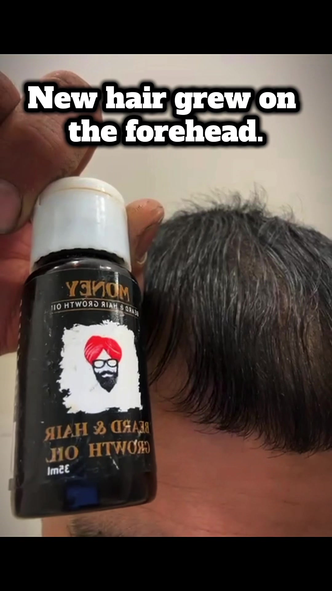 @money_beard_growthoil