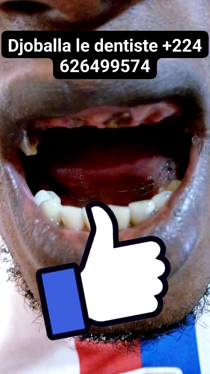 @Djoballa le dentiste