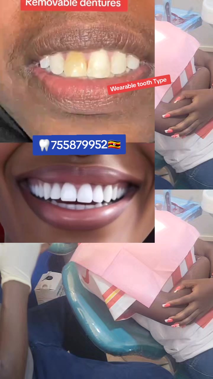 @Allianz Dental studio🦷🦷🇺🇬