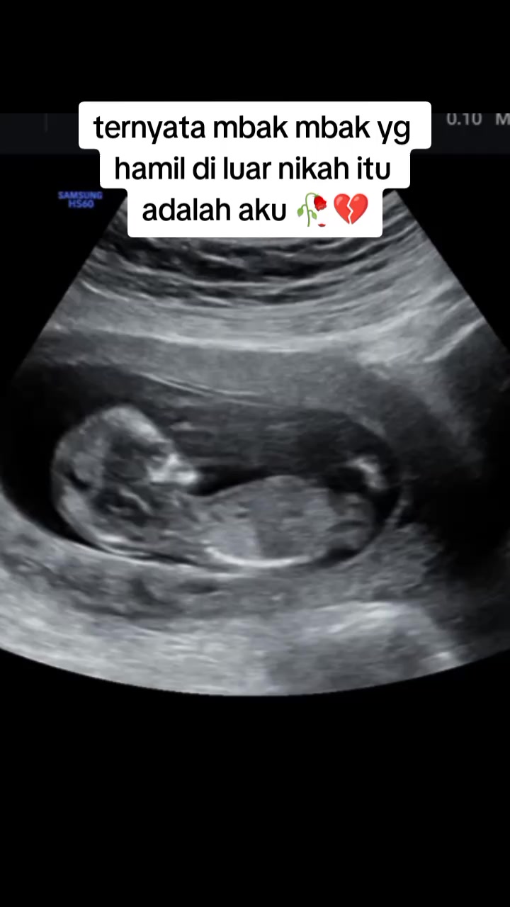 @ARISKA PUTRI
