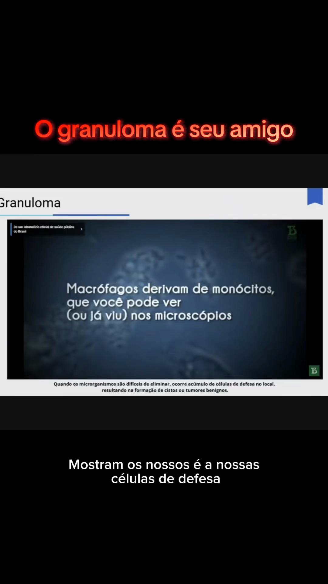 @Igor Sudano