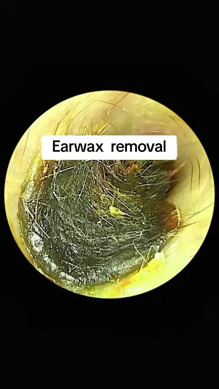 @Earwax.pro
