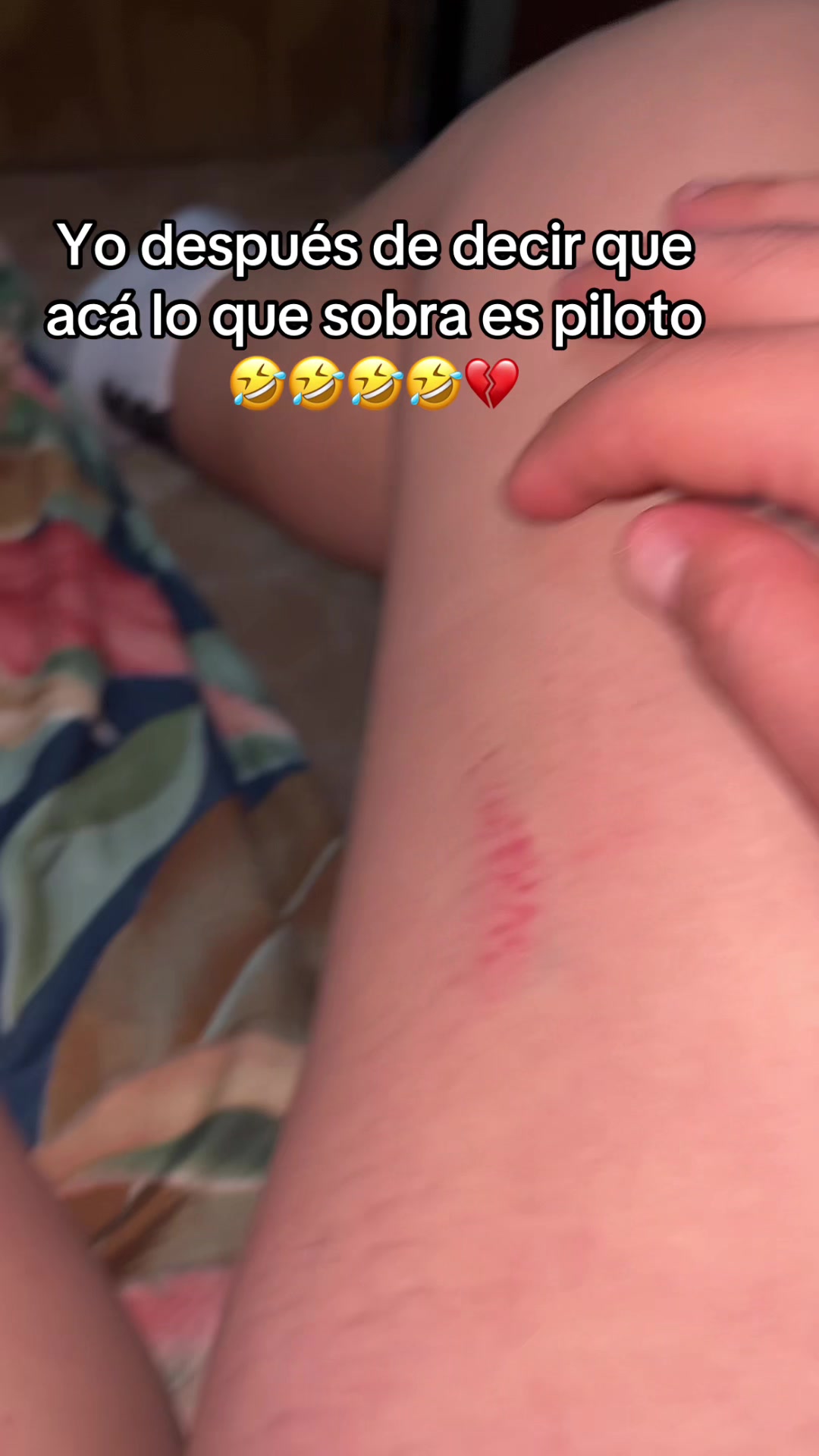 @Belu Espindola