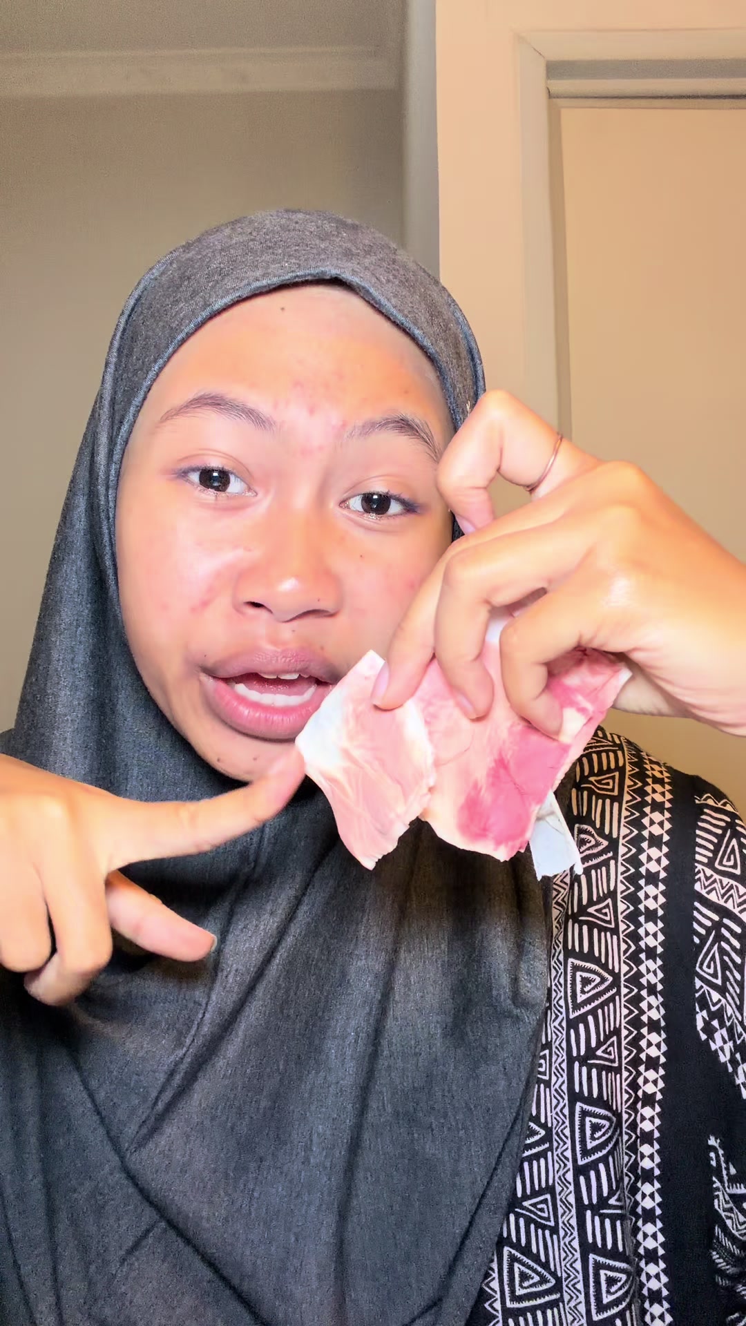 @Ini rika