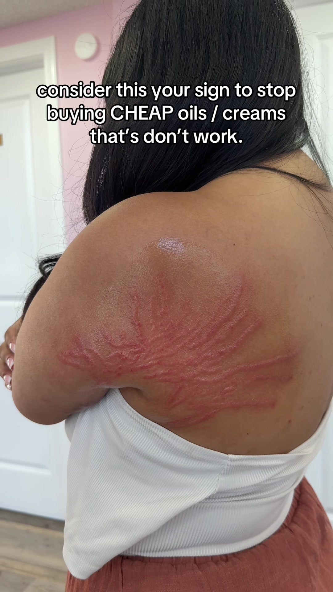 @Stretch Mark Fairy 🧚✨