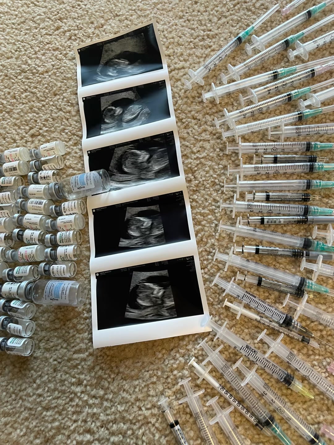 @Patricia | IVF Journey ๐ค๐
