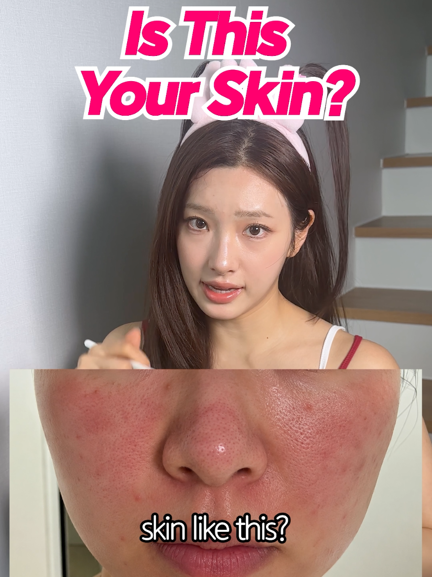 @Sunny kim