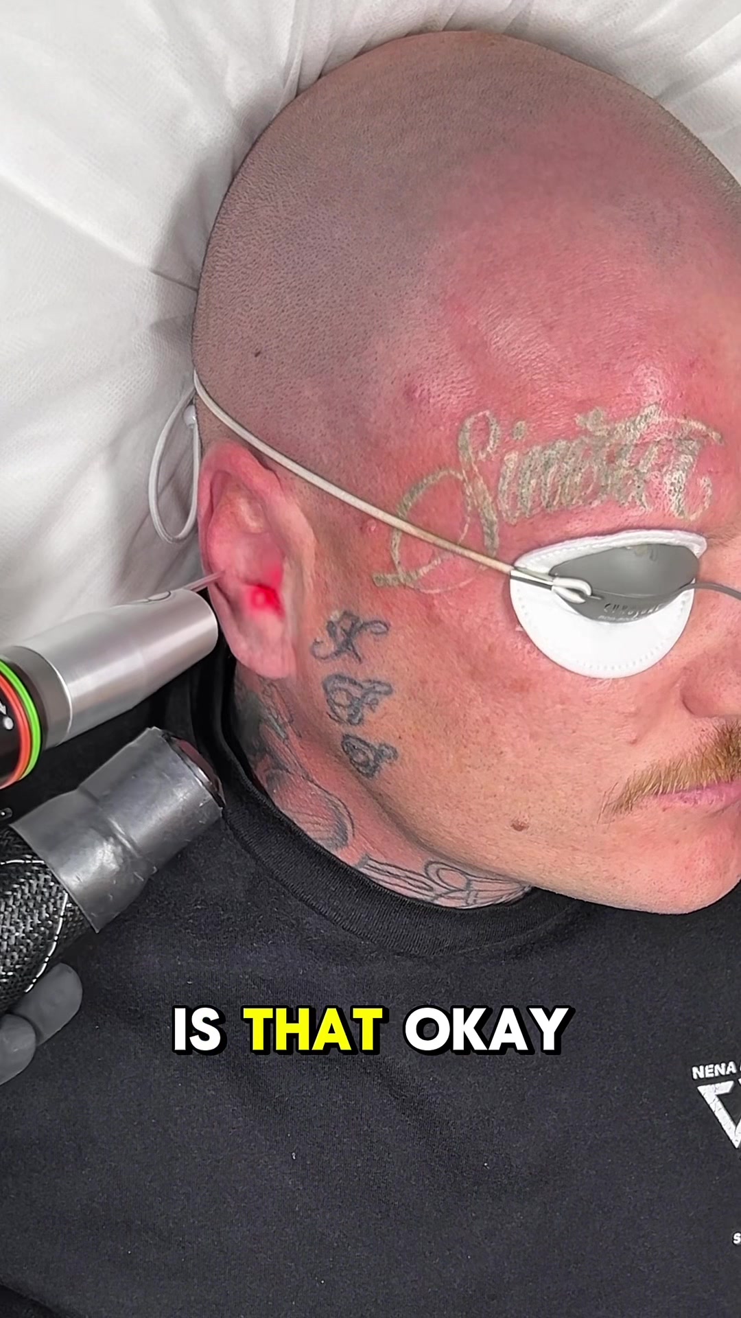 @Swift_tattoo_removal