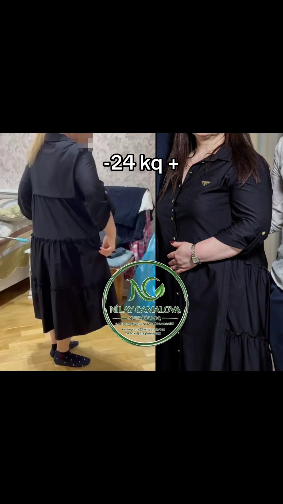 @Nutrisioloq Nilay Camalova 🥑