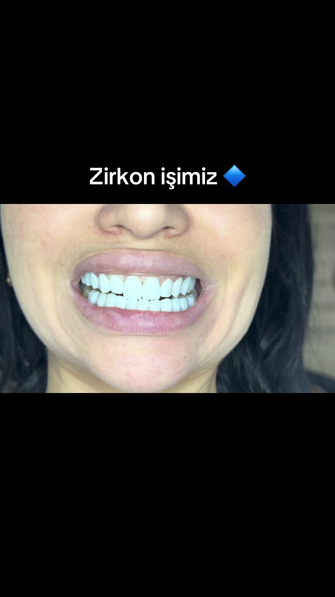 @stomatoloq diş həkimi