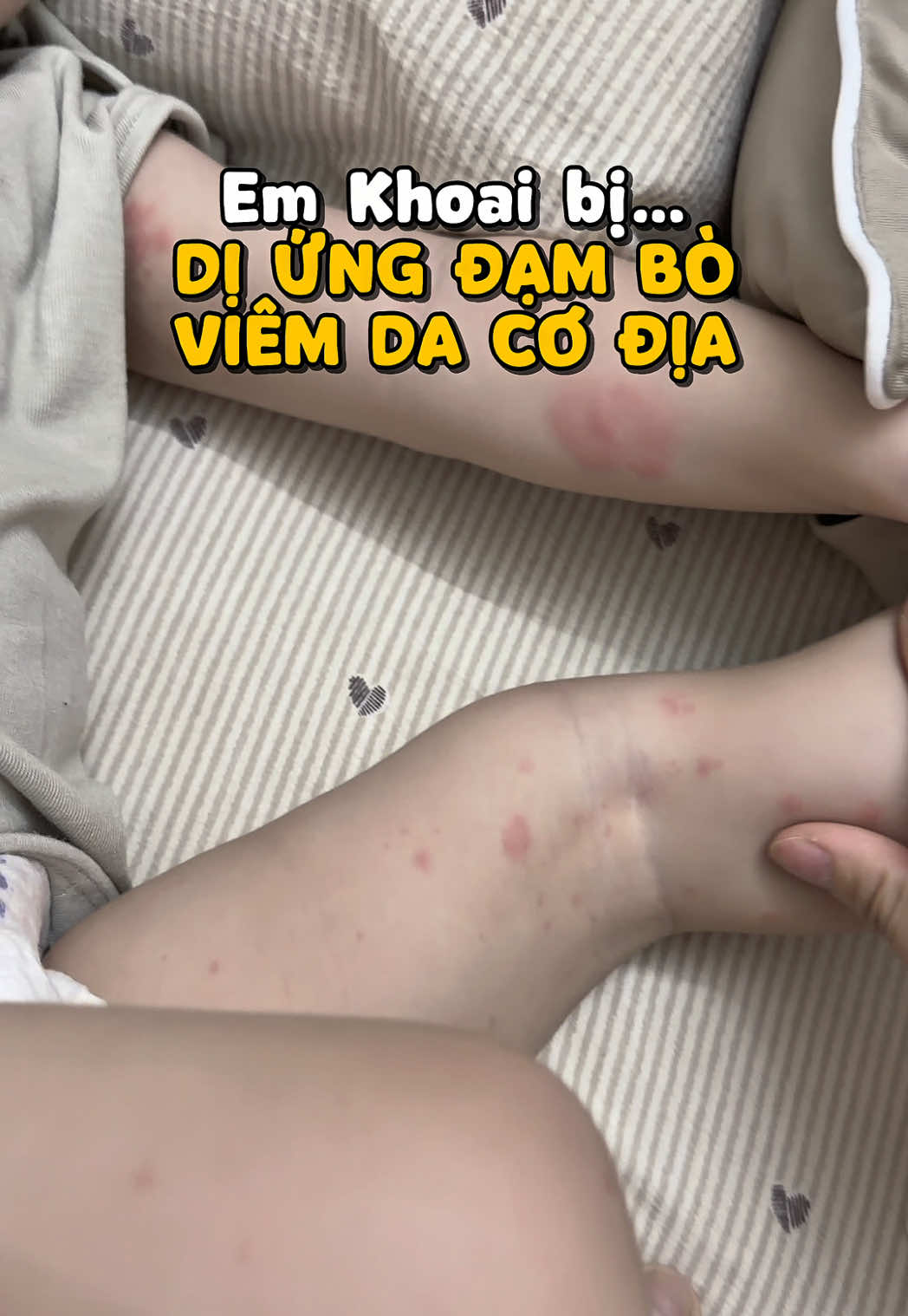 @Nhím - Mẹ em Khoai 🍠
