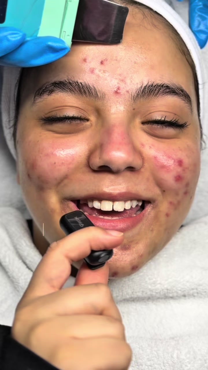 @menna_skintherapist